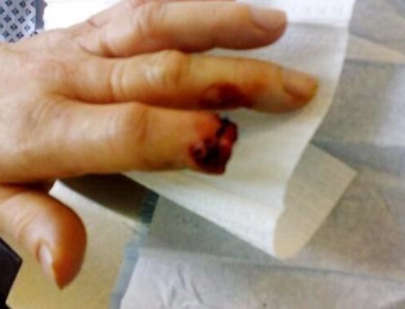 Other image for Posties suffer horrific dog attack injuries